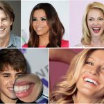 Invisalign_Celebrites